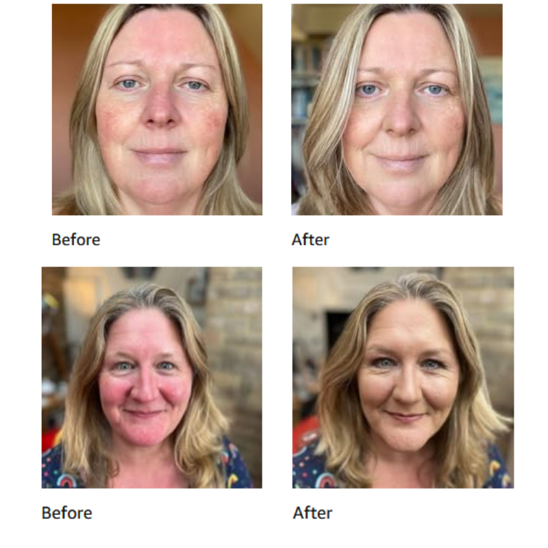 Riveton 3 in 1 Anti-Redness Formula