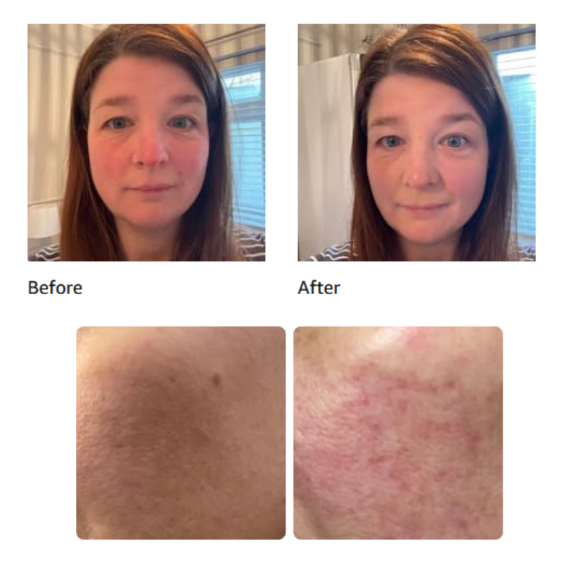 Riveton 3 in 1 Anti-Redness Formula