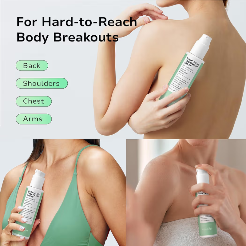 Back Acne Botanical Spray